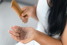 Stop Hairfall: দামি শ্যাম্পু-সিরাম নয়, চুল পড়া আটকাতে নারকেল তেলে পেঁয়াজের রসের মতো ৫ উপাদান মিশিয়ে মাখুন,কয়েকদিনেই টাকে উঁকি মারবে ছোট ছোট চুল