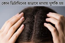কোন ভিটামিনের অভাবে খুশকিতে ভরে মাথা, জানাচ্ছন পুষ্টিবিদ! রইল বাঁচার সেরা টোটকা!