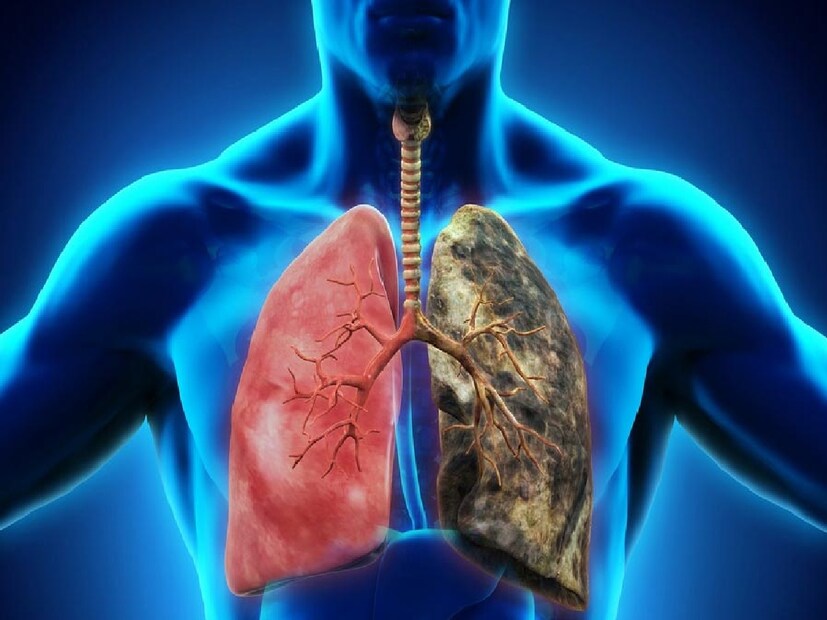 হাঁপানিতে আক্রান্তদের মধ্যে, শীতকালে ঠাণ্ডার কারণে অ্যাজমা আক্রান্তদের সংখ্যা সবচেয়ে বেশি। এতে সংকীর্ণ শ্বাসনালী আরও সংকীর্ণ হয়ে যায়। হাঁপানি রোগীদের শ্বাস নিতেও রীতিমতো যুদ্ধ করতে হয়।