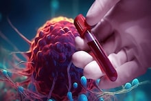 Cancer Best Treatment: উত্তরবঙ্গবাসীদের জন্য বিরাট সুখবর! এবারে শিলিগুড়িতেই হবে ক্যানসারের চিকিৎসা, কেমোথেরাপি অস্ত্রোপচার! জানুন বিস্তারিত