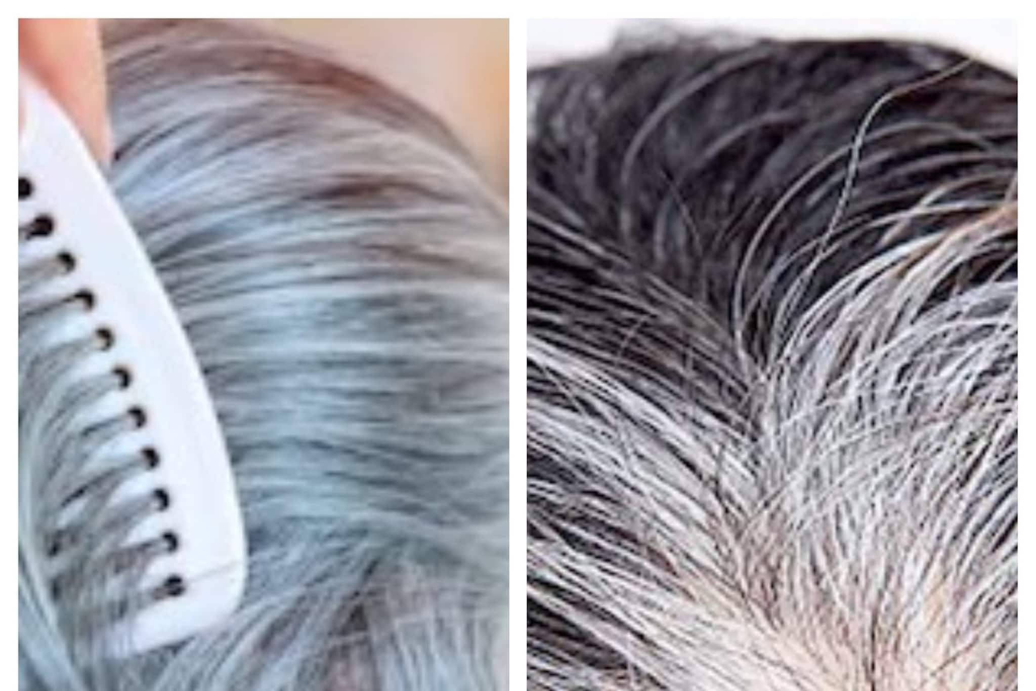 White Hair Colouring: বেকার দামি কালার-কলপ! আমলকি আর কালো চায়ের গুণে সাদা চুল কালো টানা কয়েক মাস!