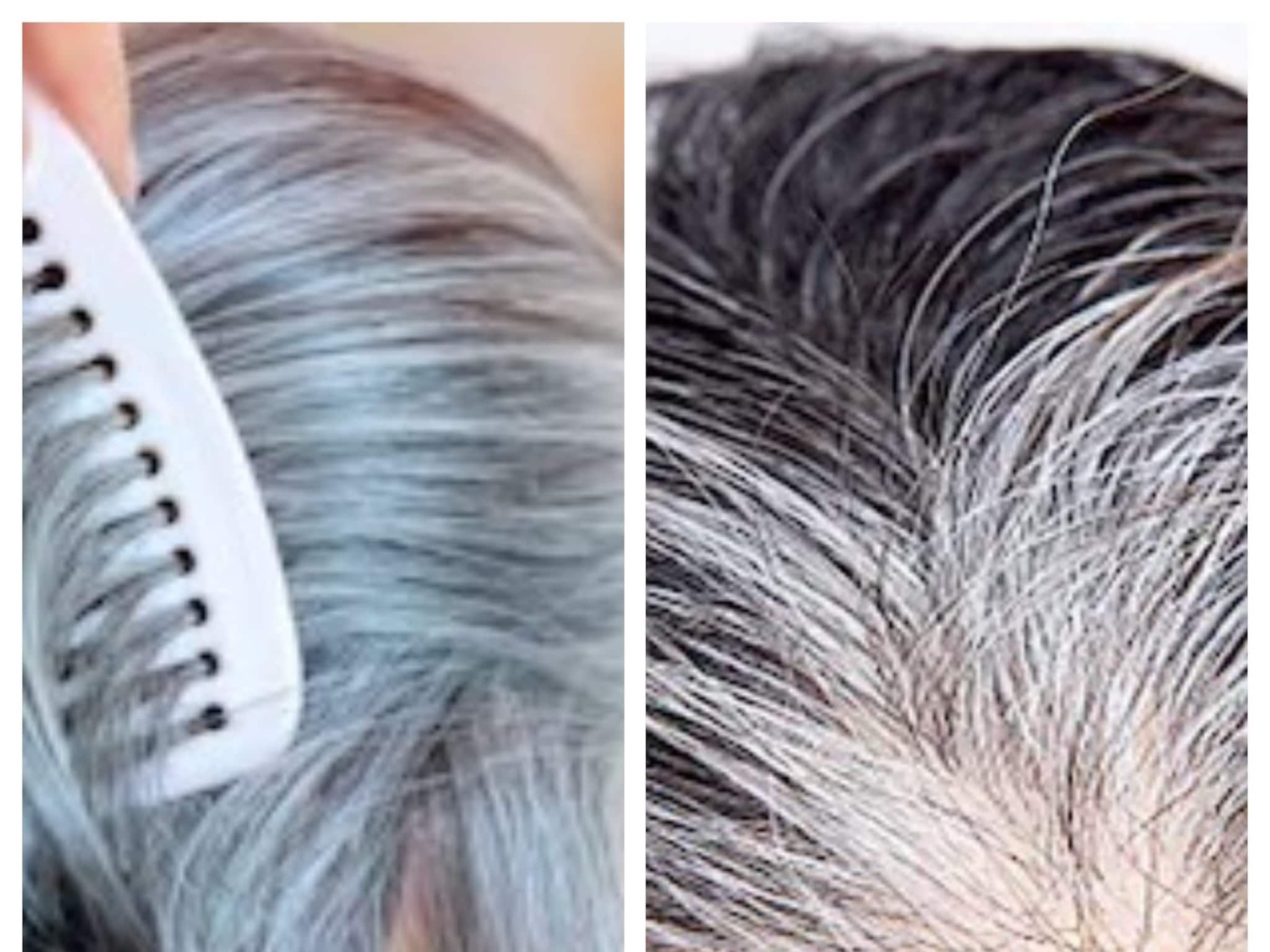 White Hair Colouring: বেকার দামি কালার-কলপ! আমলকি আর কালো চায়ের গুণে সাদা চুল কালো টানা কয়েক মাস!