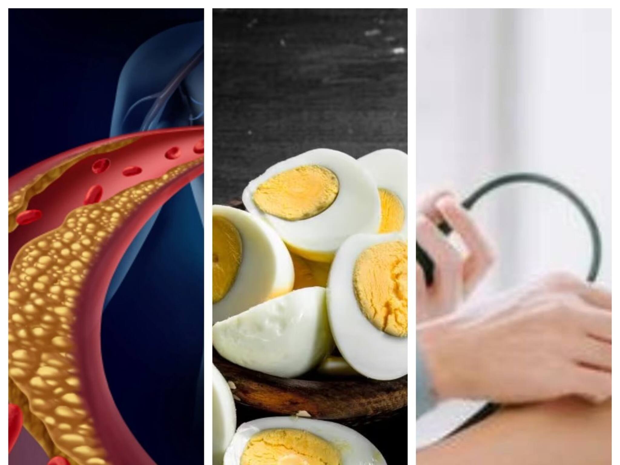 Egg in High Blood Pressure & Cholesterol: কুসুমসমেত ডিম খেলে হুড়মুড়িয়ে বাড়ে ব্লাড প্রেশার, কোলেস্টেরল? ডেকে আনে হার্টের রোগ? জানুন