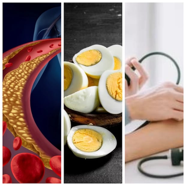 যে কোনও ক্রনিক রোগেই ডায়েট নিয়ে চিন্তা থেকে যায়৷ হাই ব্লাড প্রেশারও তার ব্যতিক্রম নয়৷ উচ্চ রক্তচাপের ক্ষেত্রে প্রথমেই প্রশ্ন আসে মনে যে ব্লাড প্রেশারে কি ডিম খাওয়া যায়? ডিম খেলে কি কোলেস্টেরল বেড়ে হৃদরোগ হয়?