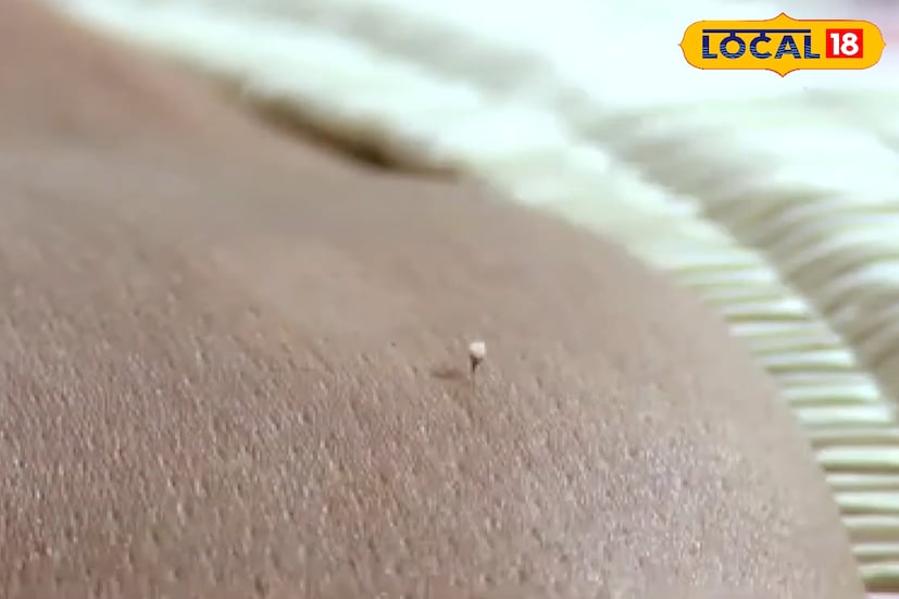 টুথপেস্টও সুন্দরবনের মৌলদের ভরসার একটি দ্রুত উপায়। মৌমাছি কামড়ানোর পর অনেকেই আক্রান্ত জায়গায় পাতলা করে টুথপেস্ট লাগান। এতে জ্বালাপোড়া কমে এবং টুথপেস্টের অ্যালকালাইন উপাদান বিষের প্রভাবও অনেকটা নিষ্ক্রিয় করে দেয় বলে মনে করা হয়।