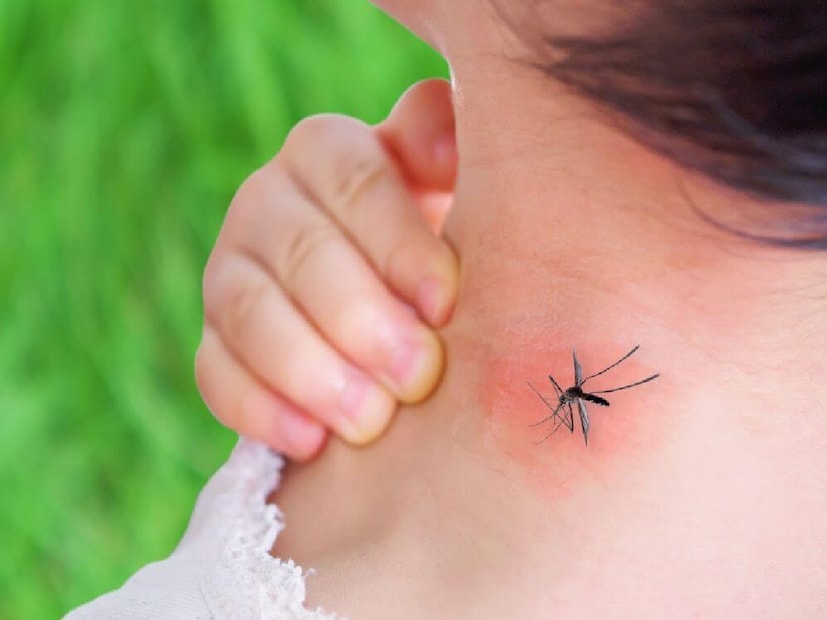 *কর্পূর, কালো মরিচ এবং পেঁয়াজের তীব্র গন্ধ মশার পক্ষে অসহনীয়। এই পেঁয়াজের প্রদীপটি তৈরি করে দেখুন। এটি মশা মেরে ফেলবে এবং ক্ষতিকারক মশা তাড়ানোর জন্য আপনার অর্থ সাশ্রয় করবে।