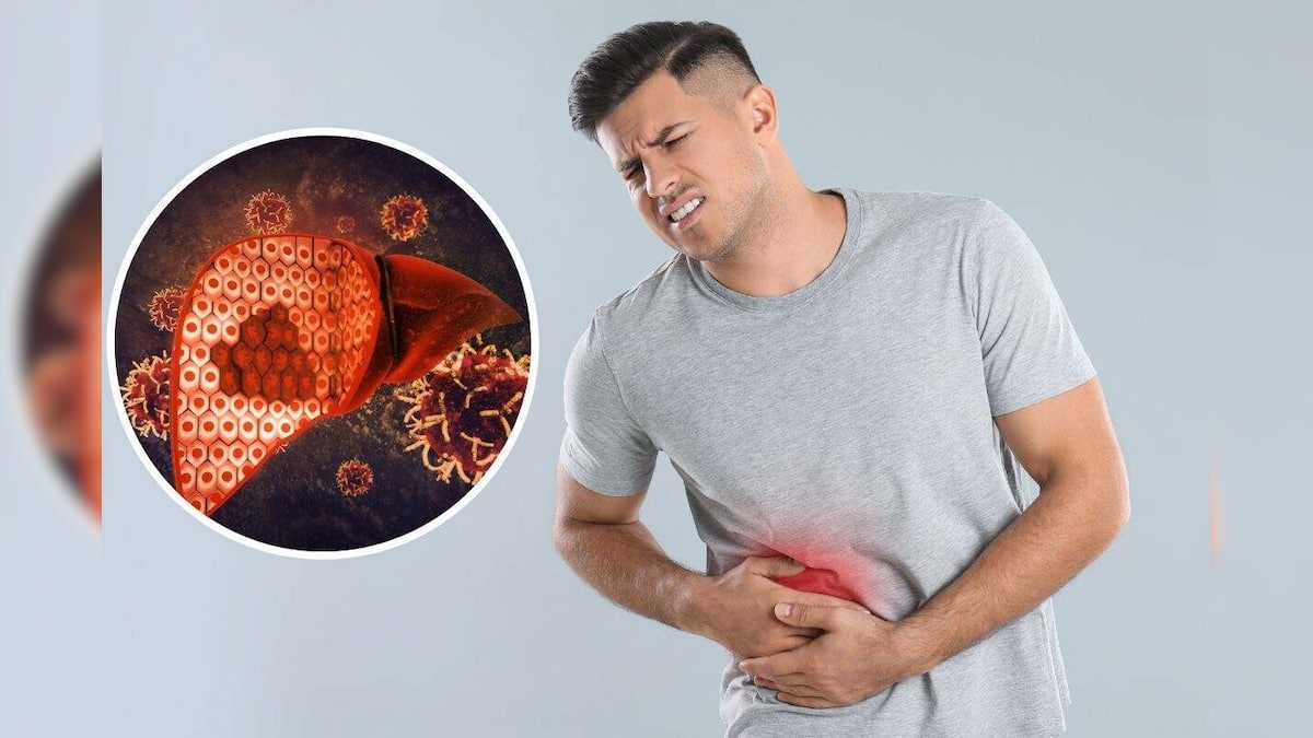 ফ্যাটি লিভারের অসুবিধা? প্রাকৃতিক ঘরোয়া উপায়েই হবে সমাধান… লিভার চাঙ্গা থাকবে আজীবন ফ্যাটি লিভারের অসুবিধা? প্রাকৃতিক ঘরোয়া উপায়েই হবে সমাধান… লিভার চাঙ্গা থাকবে আজীবন