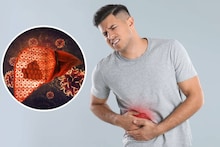 Liver Damaging Food: শুধু তেল নয়! চিনি, ময়দা...রোজকার অনেক খাবারই লিভারের জন্য চরম বিষাক্ত! কী কী খেলে পচবে লিভার,জানুন!