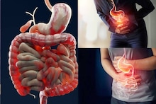 Constipation & Acidity: মৌরি আর গুড়ের কেরামতিতে জব্দ শীতের কোষ্ঠকাঠিন্য! কর্পূরের মতো উবে যায় গ্যাস-অম্বলের অস্বস্তি!