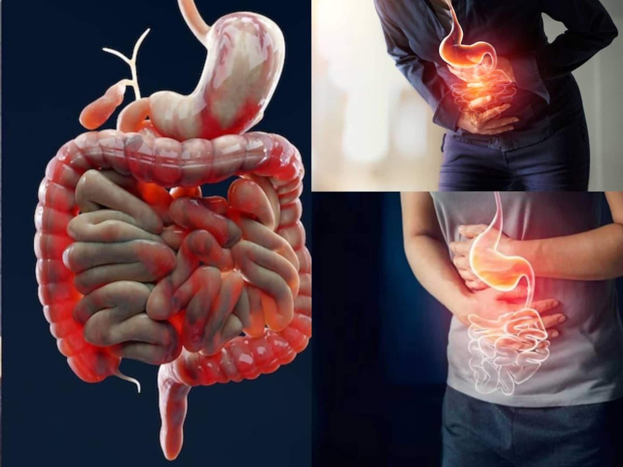 Constipation & Acidity: মৌরি আর গুড়ের কেরামতিতে জব্দ শীতের কোষ্ঠকাঠিন্য! কর্পূরের মতো উবে যায় গ্যাস-অম্বলের অস্বস্তি!