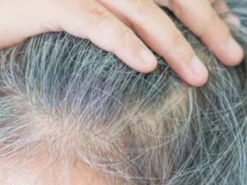 বুন্দেলখণ্ড অঞ্চলে, অমলতাস গাছ, যা স্থানীয়ভাবে তেসু বা চিভলা নামেও পরিচিত , সাধারণত প্রাকৃতিক চিকিৎসায় ব্যবহৃত হয়। এবং এটি দিয়ে, আপনি বাড়িতেই আপনার চুল কালো করার জন্য একটি সম্পূর্ণ প্রাকৃতিক প্রতিকার প্রস্তুত করতে পারেন।