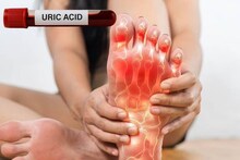 Uric Acid Home Remedies: শীতে ইউরিক অ্যাসিডের ব্যথা বাড়ে কাঁটার মতো! যন্ত্রণায় কুঁকড়ে যাওয়া! হলুদ-সহ ৫ ঘরোয়া খাবারেই বিষমুক্ত শরীর!