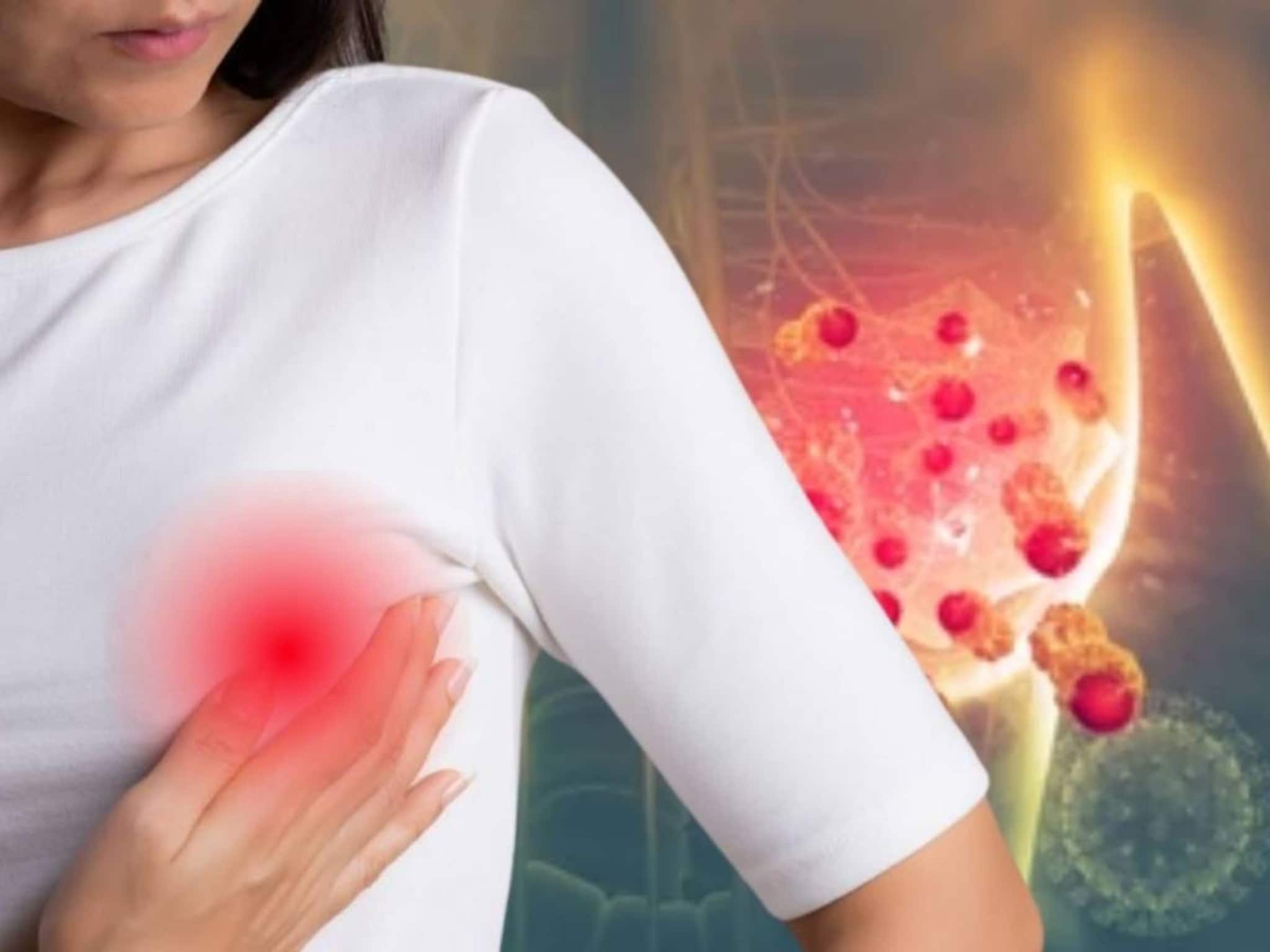 Male Breast Cancer: মহিলাদের মতো পুরুষদেরও হয় Breast Cancer! লক্ষণ কী জানুন! রইল বাঁচার উপায়!