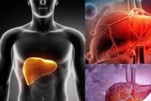 Liver Cleaning Food: লেবু, আদা, হলুদ, রসুন, গোলমরিচ...গুনে গুনে ১০ টা জিনিস খেলে বিষাক্ত নোংরা চর্বি বেরিয়ে পরিষ্কার লিভার!