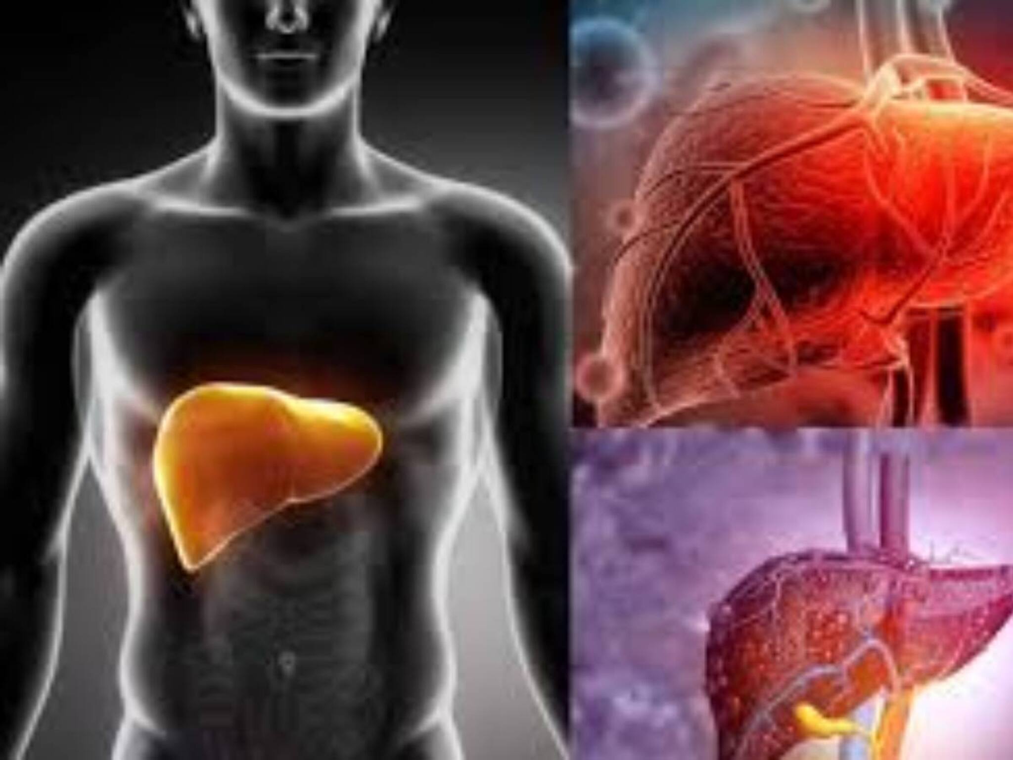 Liver Cleaning Food: লেবু, আদা, হলুদ, রসুন, গোলমরিচ...গুনে গুনে ১০ টা জিনিস খেলে বিষাক্ত নোংরা চর্বি বেরিয়ে পরিষ্কার লিভার!