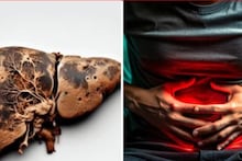 পেট ব্যথা, গোড়ালি ফোলা...গুনে গুনে ৫ লক্ষণ! বাড়তে পারে নোংরা চর্বি! পচতে পারে লিভার!