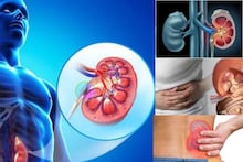 Food to cause Kidney Stone: পাথর জমে শিকেয় উঠবে কিডনির কাজ! ভুলেও খাবেন না এই ‘সবুজ শাক’ এবং ‘লাল সবজি’! ঝাঁঝরা হবে শরীরের ছাঁকনি