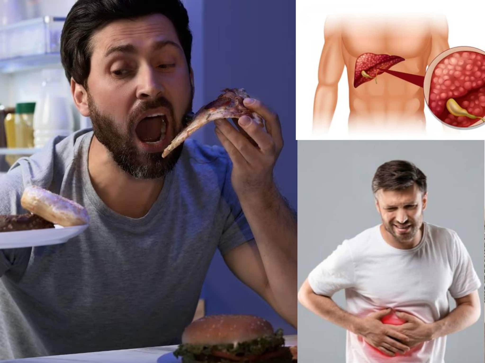 Food to cause Fatty Liver: শুধুই নয় মদ-তেল! চিনি, চিপস, পনিরের মতো কিছু খাবারেই পচবে লিভার! নোংরা চর্বি জমে দফারফা পেটের