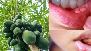 ঘরোয়া প্রতিকার হল পেঁপে পাতা থেকে তৈরি সাদা দুধ