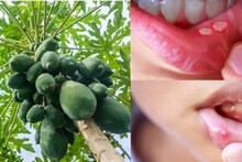 Mouth Ulcer Home Remedy: জিভ ও মুখের ঘায়ে ধন্বন্তরি! জ্বালাপোড়া কমিয়ে আরাম পেতে মাউথ আলসারে দিন পেঁপে পাতার 'দুধ'!