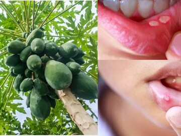 ঘরোয়া প্রতিকার হল পেঁপে পাতা থেকে তৈরি সাদা দুধ ঘরোয়া প্রতিকার হল পেঁপে পাতা থেকে তৈরি সাদা দুধ