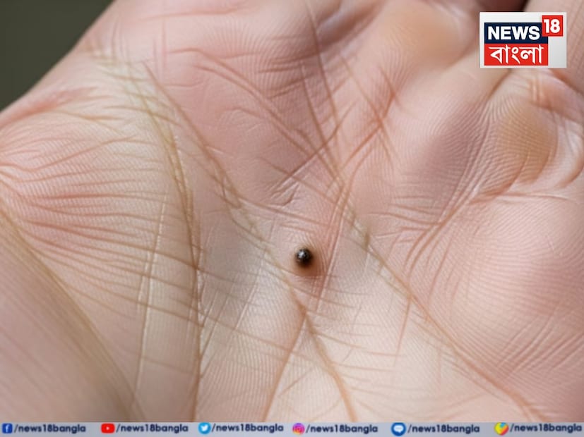 সামুদ্রিক শাস্ত্রে, অনেক জায়গায় তিল চিহ্নকে শুভ বলে মনে করা হয়। কিন্তু হস্তরেখা অনুসারে, যদি আপনার হাতের যেকোনও জায়গায় তিল থাকে, তাহলে এর শুভ এবং অশুভ প্রভাব থাকতে পারে। সামুদ্রিক শাস্ত্রে, অনেক জায়গায় তিল চিহ্নকে শুভ বলে মনে করা হয়। কিন্তু হস্তরেখা অনুসারে, যদি আপনার হাতের যেকোনও জায়গায় তিল থাকে, তাহলে এর শুভ এবং অশুভ প্রভাব থাকতে পারে।