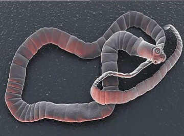 এই ৭ সবজিতে কিলবিল করে ফিতাকৃমি, সোজা পৌঁছে যায় মাথায়, কুরে কুরে খায় ব্রেনের টিস্যু