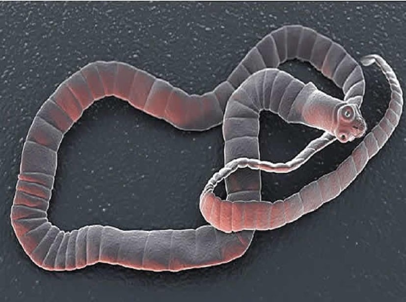 বছরভর সুস্থ থাকার অন্যতম চাবিকাঠি হল পর্যাপ্ত পরিমাণে ফল ও সবজি খাওয়া! শাক-সবজিতে থাকে প্রচুর পরিমাণে ভিটামিন, খনিজ আর অ্যান্টিঅক্সিড্যান্ট! কিন্তু মাথায় রাখবেন, অনেক ফল ও সবজির মধ্যেই লুকিয়ে বিপদ, থাকে পোকামাকড় বা কৃমি! এই কৃমি শরীরে ঢুকলে পেটের সমস্যা, নানা ধরণের সংক্রমণ, এমনকী মস্তিষ্কেও খারাপ প্রভাবও ফেলতে পারে। কিছু ক্ষেত্রে তা প্রাণঘাতিও। নয়ডার মেট্রো হাসপাতালের সিনিয়র নিউরোলজিস্ট ডাঃ নীরজ কুমার বলেন, আমাদের খাদ্যতালিকায় রয়েছে এমন ৭ টি সবজি, যাতে কিলবিল করে ফিতাকৃমি বা টেপওয়ার্ম, কোন ৭ সবজি খাওয়ার আগে সাবধান?