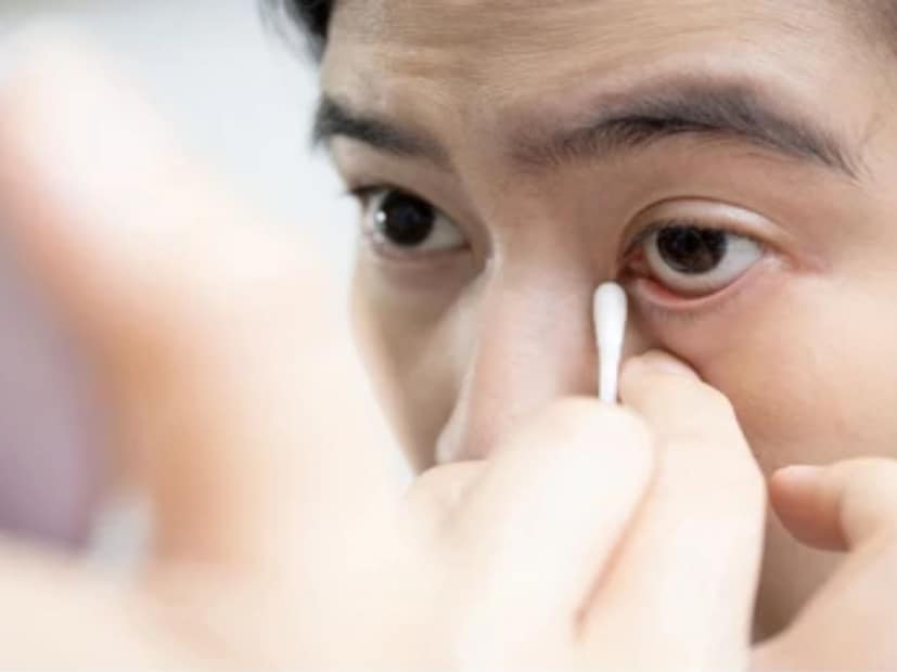 অনেকের ক্ষেত্রেই দেখা যায় স্বাভাবিকের তুলনায় বেশি পরিমাণ পিচুটি নির্গত হচ্ছে চোখের কোনা থেকে৷ প্রায়ই হলুদ বা সাদা রঙের চটচটে পদার্থ বের হয়। চোখ থেকে বেশি পরিমাণ মিউকাসের নির্গমণ পুষ্টির ঘাটতির সঙ্কেত হতে পারে৷