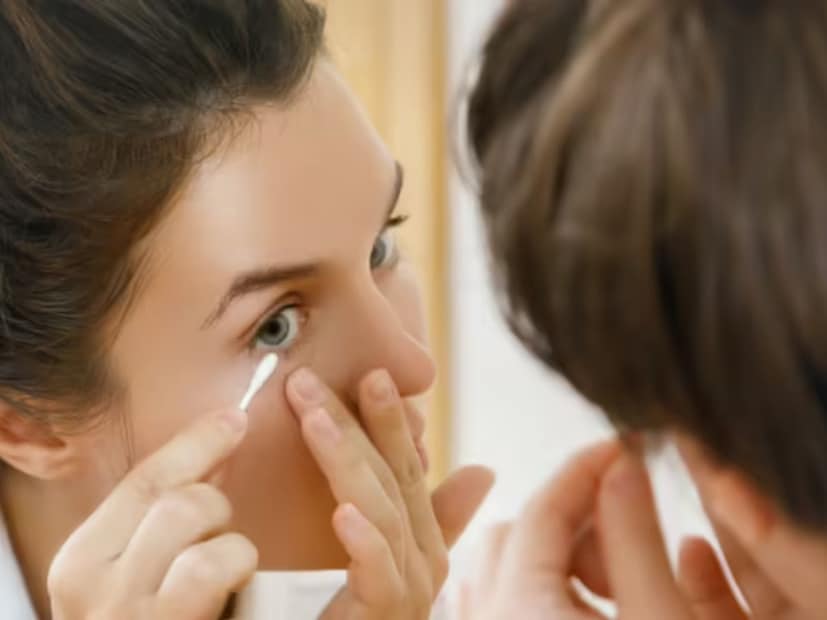 পাশাপাশি হজম, লিভার এবং গলব্লাডারকে সুস্থ রাখুন। যদি পিচুটি খুব বেশি হয়, লালচে বা ব্যথা হয় তাহলে অবশ্যই এ বিষয়ে চিকিৎসকের পরামর্শ নেওয়া উচিত৷ 