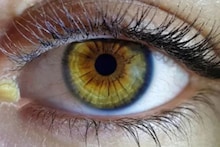 Vitamin Deficiency: ঘুম ভাঙলেই চোখের কোনে জমে প্রচুর পিচুটি! কোন ভিটামিনের অভাবে অতিরিক্ত পিচুটি হয় জানুন, কোনও রোগের লক্ষণ নয় তো!