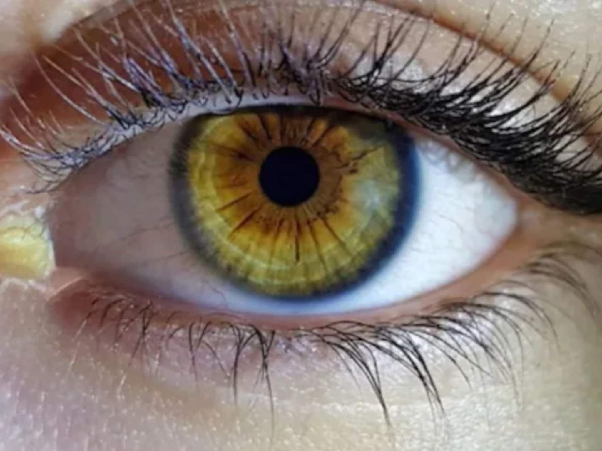 Vitamin Deficiency: ঘুম ভাঙলেই চোখের কোনে জমে প্রচুর পিচুটি! কোন ভিটামিনের অভাবে অতিরিক্ত পিচুটি হয় জানুন, কোনও রোগের লক্ষণ নয় তো!