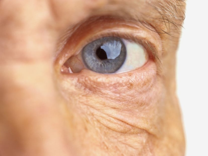 ডায়াবেটিক চক্ষু রোগের কারণ হল রক্তে শর্করার উচ্চ মাত্রা থেকে ঘটে যাওয়া বেশ কয়েকটি দৃষ্টি-সম্পর্কিত জটিলতা। এর মধ্যে সবচেয়ে সাধারণ হল ডায়াবেটিক রেটিনোপ্যাথি, যা রেটিনার ছোট রক্তনালীগুলির ক্ষতির ফলে ঘটে।