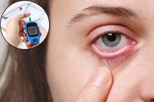 Diabetes: ডায়াবেটিস আঘাত হানে চোখেও, নীরবে দৃষ্টিশক্তি হ্রাস পায়, সচেতন করছেন প্রখ্যাত চক্ষুবিশেষজ্ঞ