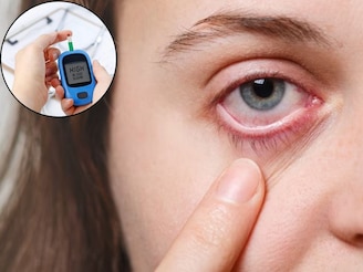 ডায়াবেটিস আঘাত হানে চোখেও, নীরবে দৃষ্টিশক্তি হ্রাস পায়, সচেতন করছেন প্রখ্যাত চক্ষুবিশেষজ্ঞ