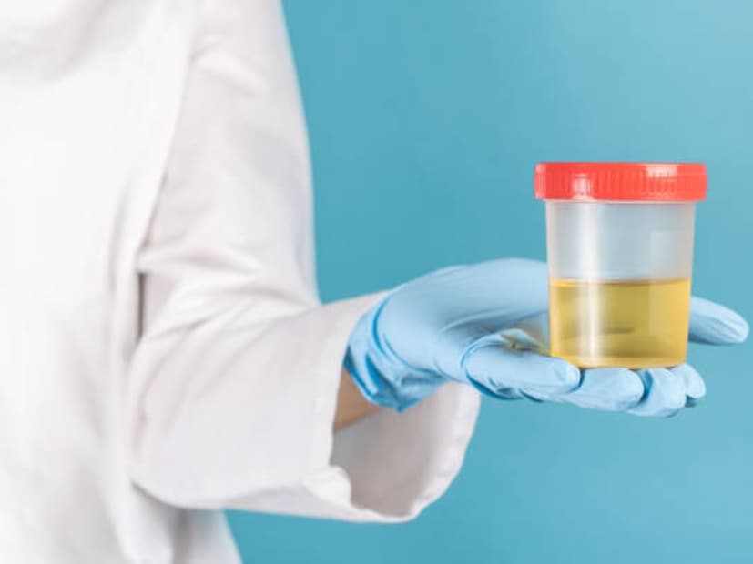 কিন্তু বেশিরভাগ ক্ষেত্রেই এই লক্ষণ গুলিকে সাধারণ ভেবে এড়িয়ে যান সকলে। কিন্তু সিম্পটম্পস চিনতে পারলে বহু মারণ রোগকেই একেবারে প্রথম লগ্নেই চিনে নেওয়া যায়। ফলে চিকিত্&#x200d;সাও সহজ হয়। ডায়াবেটিস, কোলেস্টেরলের মতো চেনা সমস&#x200d;্যাগুলি শরীরে দানা বাঁধার আগে বিভিন্ন সংকেত দিয়ে জানান দেয়। সেই সংকেত দেখা যায় বিভিন্নভাবে।