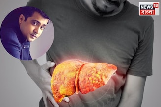 লিভার সিরোসিসে মৃত্যু অভিনেতার, কোন লক্ষণে বুঝবেন আপনার শরীরে বাসা বেঁধেছে এই কঠিন রোগ