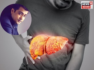 লিভার সিরোসিসে মৃত্যু অভিনেতার, কোন লক্ষণে বুঝবেন আপনার শরীরে বাসা বেঁধেছে এই কঠিন রোগ