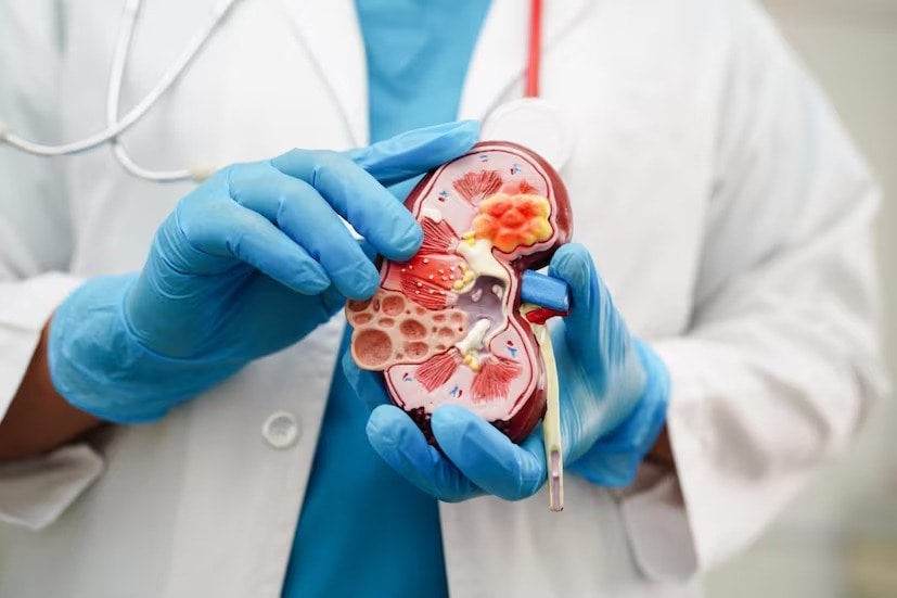 কঠোর খাদ্যতালিকা মেনে ছোট জরুরি : কিডনির উপর চাপ এড়াতে খাদ্যে লবণ গ্রহণ কমানো উচিত। এছাড়াও, প্রোটিন এবং পটাসিয়াম খাবার এড়িয়ে চলা বা কম খাওয়া উচিত। এই ধরণের খাবার এড়িয়ে খাদ্যতালিকা অনুসরণ করা শ্রেয়।