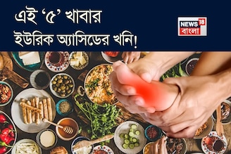 এই ‘৫’ খাবারও ইউরিক অ্যাসিডের খনি! খেলে শরীরে জমবে বিষাক্ত নোংরা! গাঁটে গাঁটে তীব্র ব্যথা