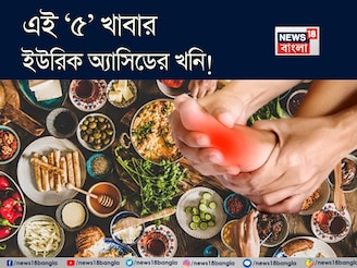 এই ‘৫’ খাবারও ইউরিক অ্যাসিডের খনি! খেলে শরীরে জমবে বিষাক্ত নোংরা! গাঁটে গাঁটে তীব্র ব্যথা