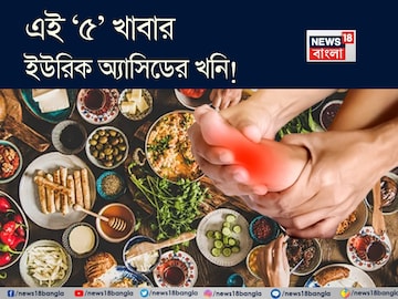এই ‘৫’ খাবারও ইউরিক অ্যাসিডের খনি! খেলে শরীরে জমবে বিষাক্ত নোংরা! গাঁটে গাঁটে তীব্র ব্যথা এই ‘৫’ খাবারও ইউরিক অ্যাসিডের খনি! খেলে শরীরে জমবে বিষাক্ত নোংরা! গাঁটে গাঁটে তীব্র ব্যথা
