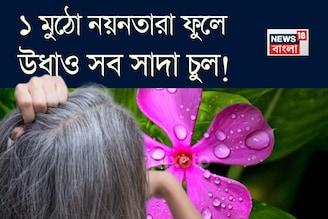 ১ মুঠো নয়নতারা! এভাবে মাখলেই বন্ধ চুল পাকা! উধাও সাদা চুল! সাফ খুশকি! গজাবে নতুন চুল!