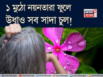 ১ মুঠো নয়নতারা! এভাবে মাখলেই বন্ধ চুল পাকা! উধাও সাদা চুল! সাফ খুশকি! গজাবে নতুন চুল!