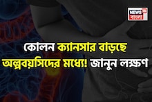 জাঙ্ক ফুড, রেড মিট বেশি  খেয়ে কোলন ক্যানসার বাড়ছে অল্পবয়সিদের! কারণ ও লক্ষণ কী? জানুন