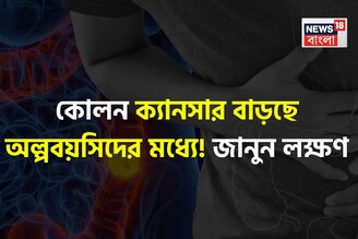 বিশেষ জিনিস বেশি বেশি খেয়ে কোলন ক্যানসার বাড়ছে অল্পবয়সিদের! কারণ ও লক্ষণ কী কী? জানুন