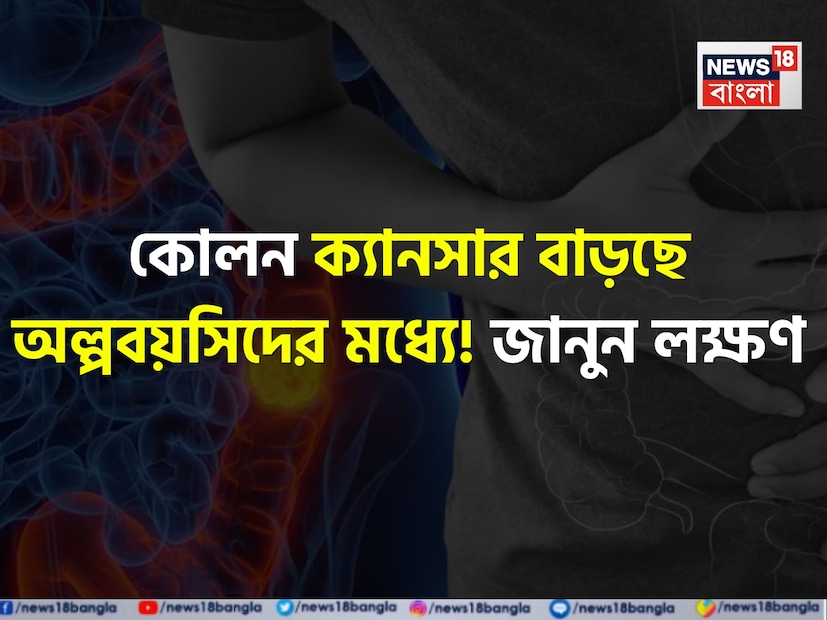 একসময় ৫০ বছরের বেশি বয়সিদের রোগ হিসেবে বিবেচিত হলেও, ২০, ৩০ এবং ৪০ বছর বয়সিদের মধ্যে কোলন ক্যানসার ক্রমশ ধরা পড়ছে। এই অস্থির প্রবণতা বিশ্বজুড়ে ডাক্তারদের মধ্যে উদ্বেগ তৈরি করছে। এই পরিবর্তন কোনও একটি অঞ্চলে সীমাবদ্ধ নয় - এমনকি ভারতেও এই রোগে আক্রান্ত তরুণ রোগীর সংখ্যা তীব্রভাবে বৃদ্ধি পাচ্ছে। জীবনযাত্রার পছন্দ, পরিবেশগত প্রভাব এবং জেনেটিক কারণগুলি প্রাথমিক পর্যায়ে শুরু হওয়া কোলন ক্যানসারের জন্য 'নিখুঁত ঝড়' তৈরি করতে একসঙ্গে কাজ করছে বলে মনে হচ্ছে।