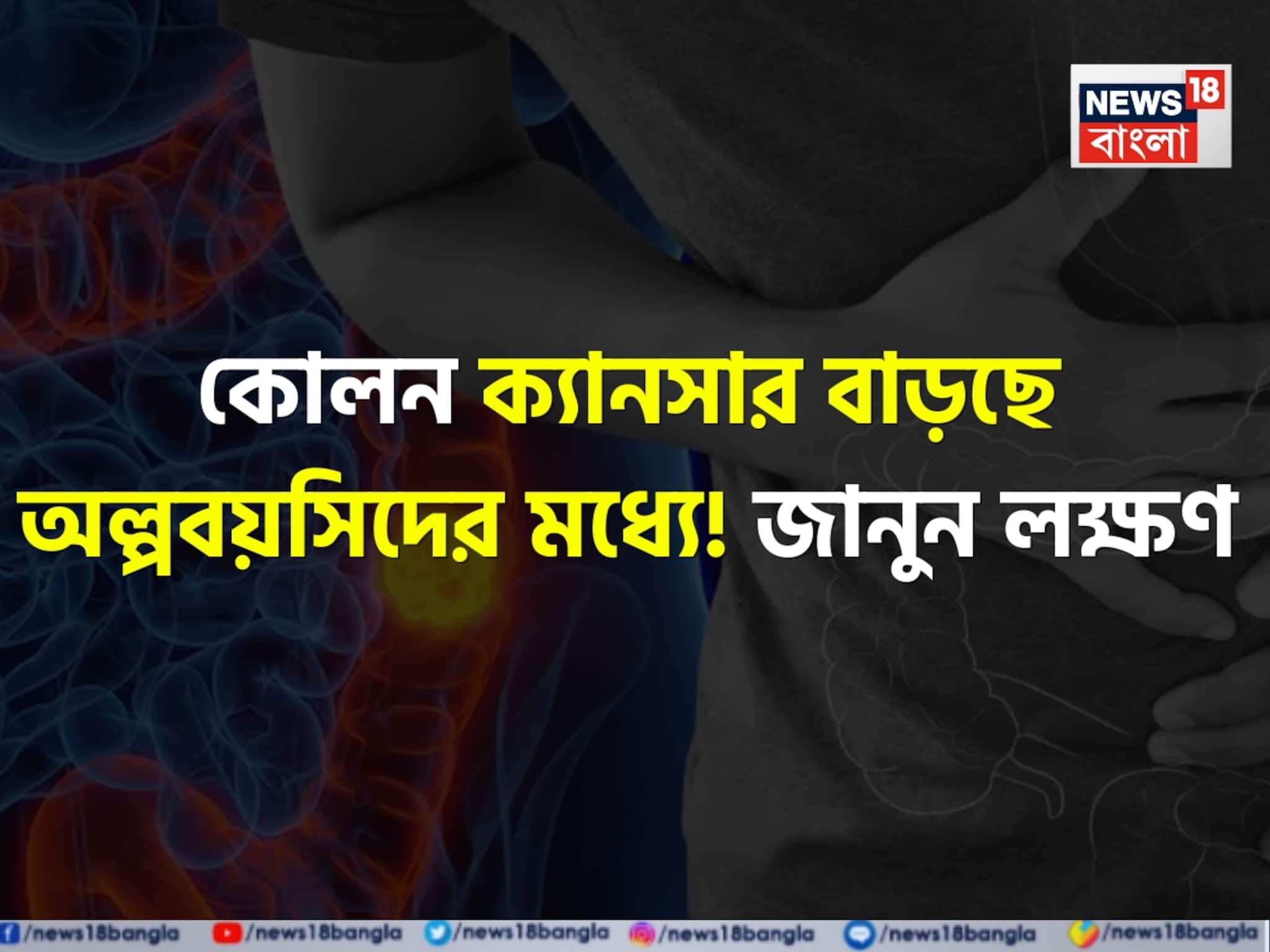 Colon Cancer Symptoms & Reasons: বিশেষ জিনিস বেশি বেশি খেয়ে কোলন ক্যানসার বাড়ছে অল্পবয়সিদের! কারণ ও লক্ষণ কী কী? জেনে নিন ডাক্তারের কাছ থেকে