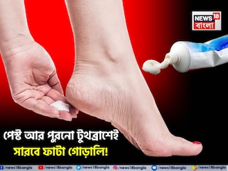 দামি ফুট ক্রিম ছাড়ুন! পেস্ট, পুরনো টুথব্রাশেই মসৃণ ফুটিফাটা! শীতেও গোড়ালি নরম তুলতুলে
