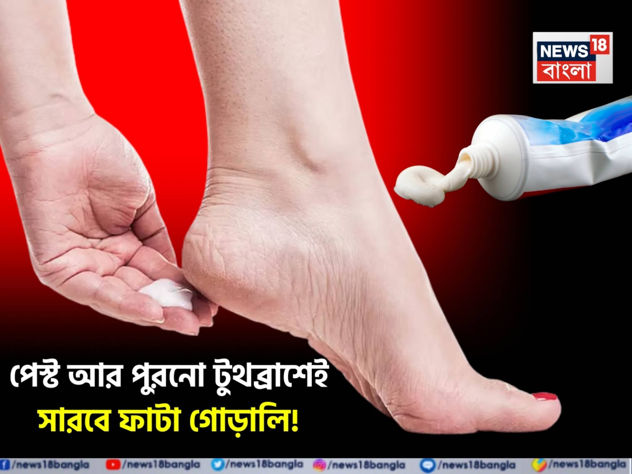Cracked Heel Remedies: দামি দামি ফুট ক্রিম ছাড়ুন! পেস্ট আর পুরনো টুথব্রাশেই মসৃণ ফুটিফাটা! শীতেও এবড়োখেবড়ো গোড়ালি নরম তুলতুলে!